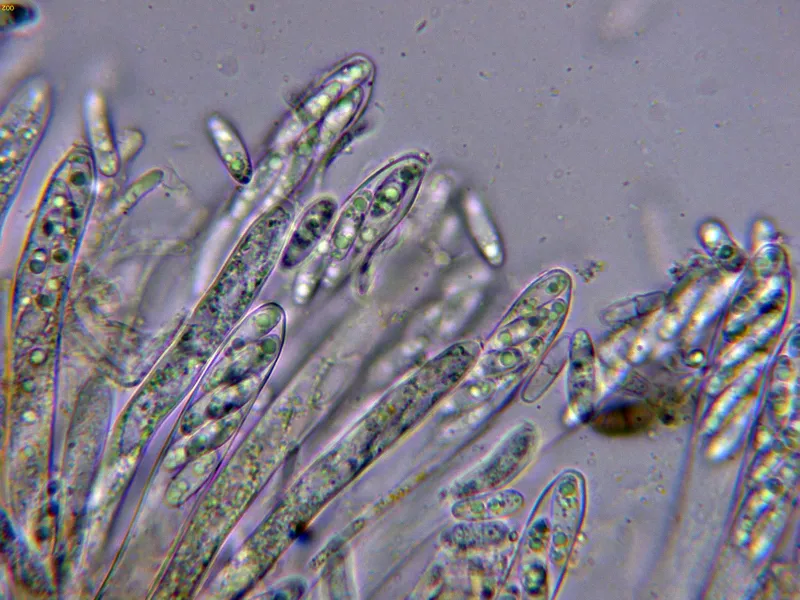 Claussenomyces prasinulus 10 - Ascos agua-002